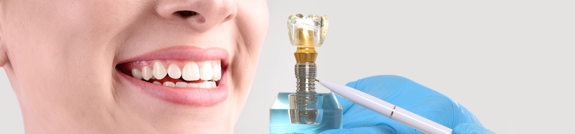 A lady getting Dental Implants Treatment