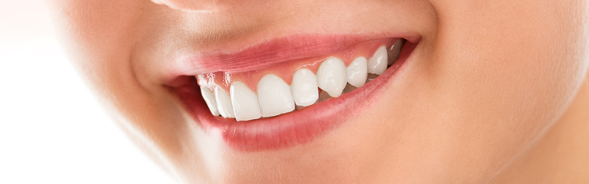 Solution to Your gummy Smile: Gum Contouring
